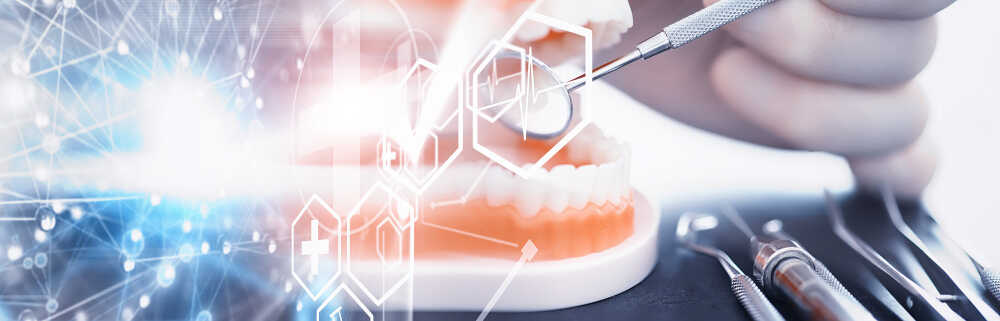 Model przedstawiający implanty zębów