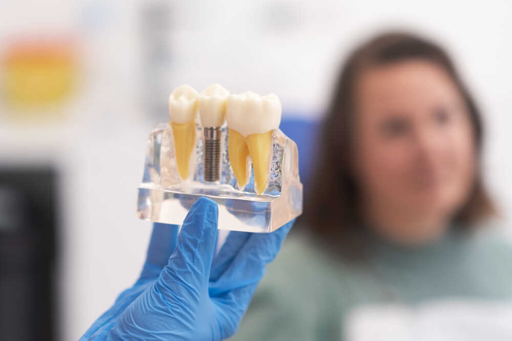 Przybliżenie przedstawiające implanty zębowe