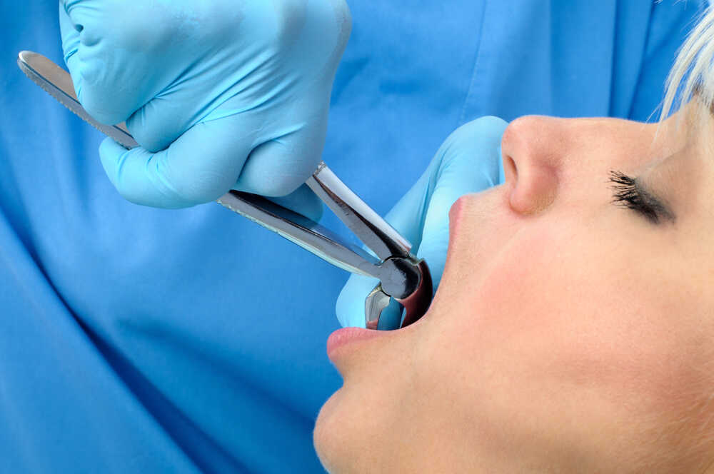 ekstrakcja zęba w klinice stomatologicznej